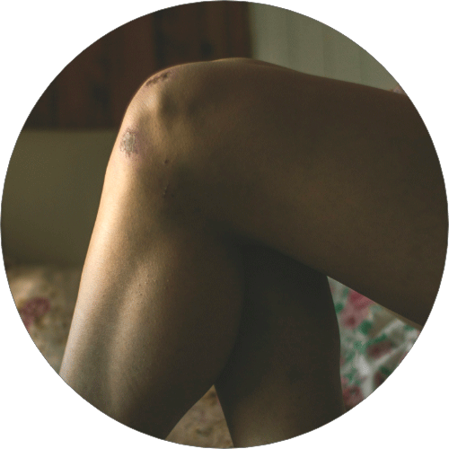 Knee